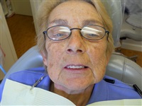But a flexible denture can save that smile.