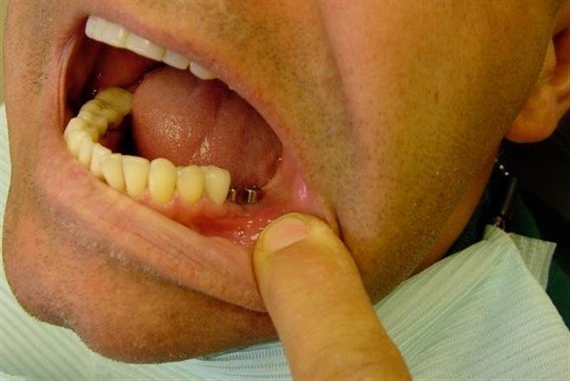Dental Emergencies Long Island Dental Emergencies Long Island